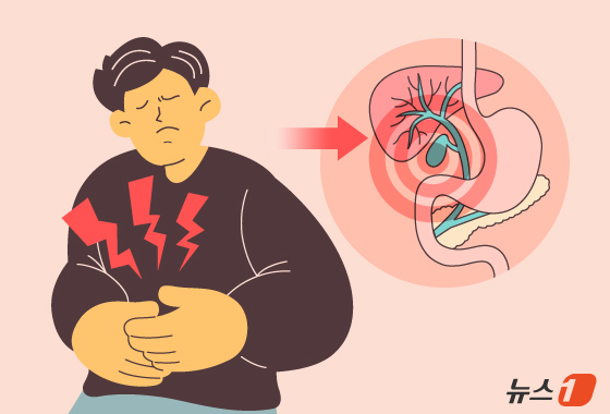 [100세건강] 오래된 담석·만성 담낭염, 암 키운다…조기 발견 중요