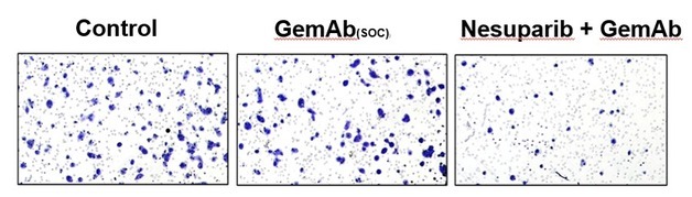 온코닉테라퓨틱스 '네수파립' 췌장암 전이 억제 확인