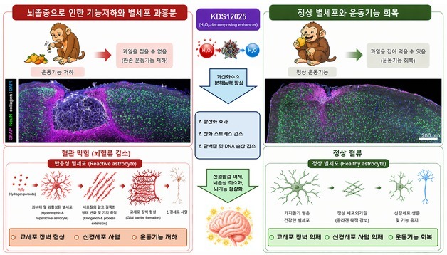 손 마비된 원숭이 회복…뇌졸중 극복할 신약 후보물질 개발