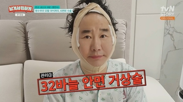 최양락, 동안 비결은 성형?…팽현숙 "박피만 18번, 쌍꺼풀 2번에 거상도"