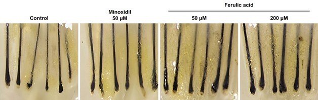 LG생활건강, 약재 '천궁'서 찾은 모발 성장 성분 개발