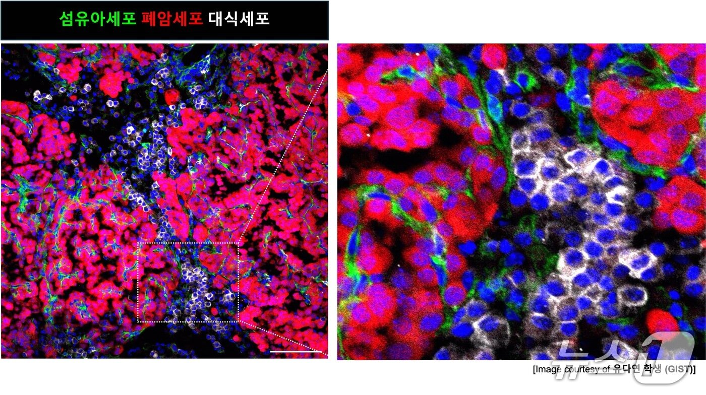 본문 이미지 - 초기 폐암에서 돌연변이 줄기세포가 주변 환경을 바꾸는 과정도(  (지스트 제공, 재판매 및 DB금지)/ 뉴스1 