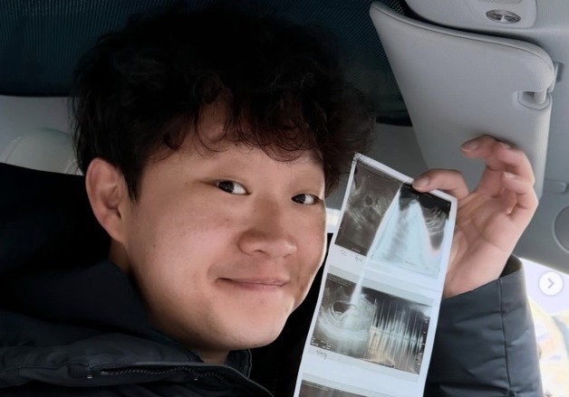 '피식대학' 정재형, 아빠 된다…태아 초음파 사진 공개