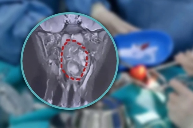 6세 아이 목에 자라난 혹, 이런 희소 질환도 있나…50만 명당 1명꼴 깜짝