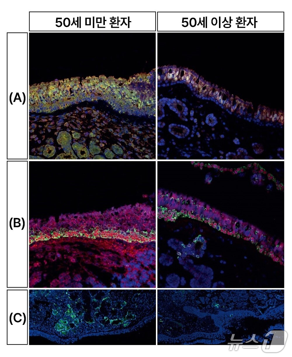 본문 이미지 - 50세 미만 환자(왼쪽)와 50세 이상 환자(오른쪽)의 세포 형광 염색 결과.(분당서울대병원 제공)