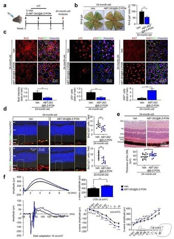 본문 이미지 - 노화된 쥐에 Bst2 표적 나노입자를 주사했을 때 망막 구조 및 기능 회복 효과 검증.(UNIST 제공. 재판매 및 DB금지)/뉴스1