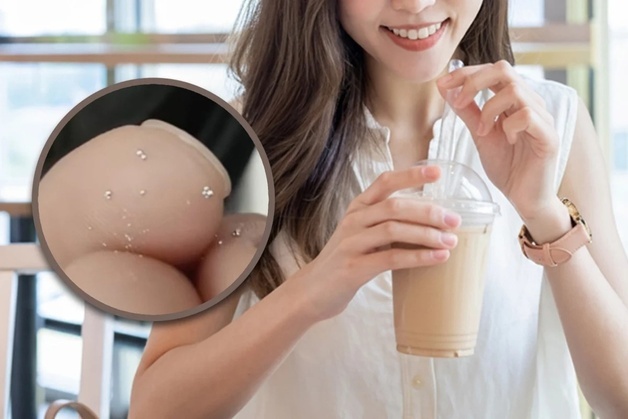 남친이 사준 밀크티에서 수은 알갱이, 독살 시도?…매장 "우린 안 넣었다"