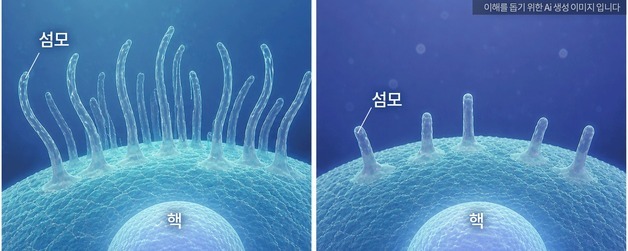 자폐 발병 원인 새 단서 찾았다…"'유전자 쌍'이 위험 높여"