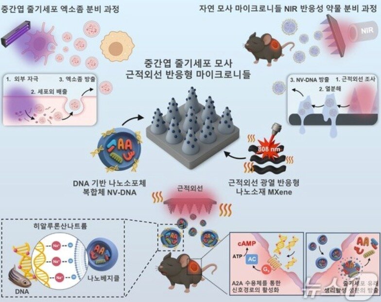 본문 이미지 - 만성 당뇨성 창상 치료를 위한 줄기세포 모사 근적외선(NIR) 반응형 마이크로니들 개요도(한국연구재단 제공)