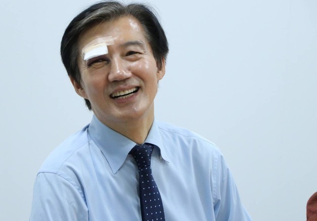 부상 당한 조국 "멍든 눈으로도 뚜벅이는 계속…액땜 격려도"