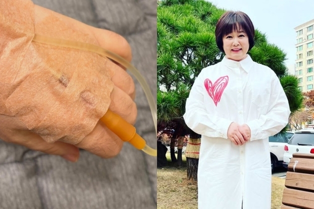 이금희, 목 건강 이상 고백…"의사가 묵언 권해"