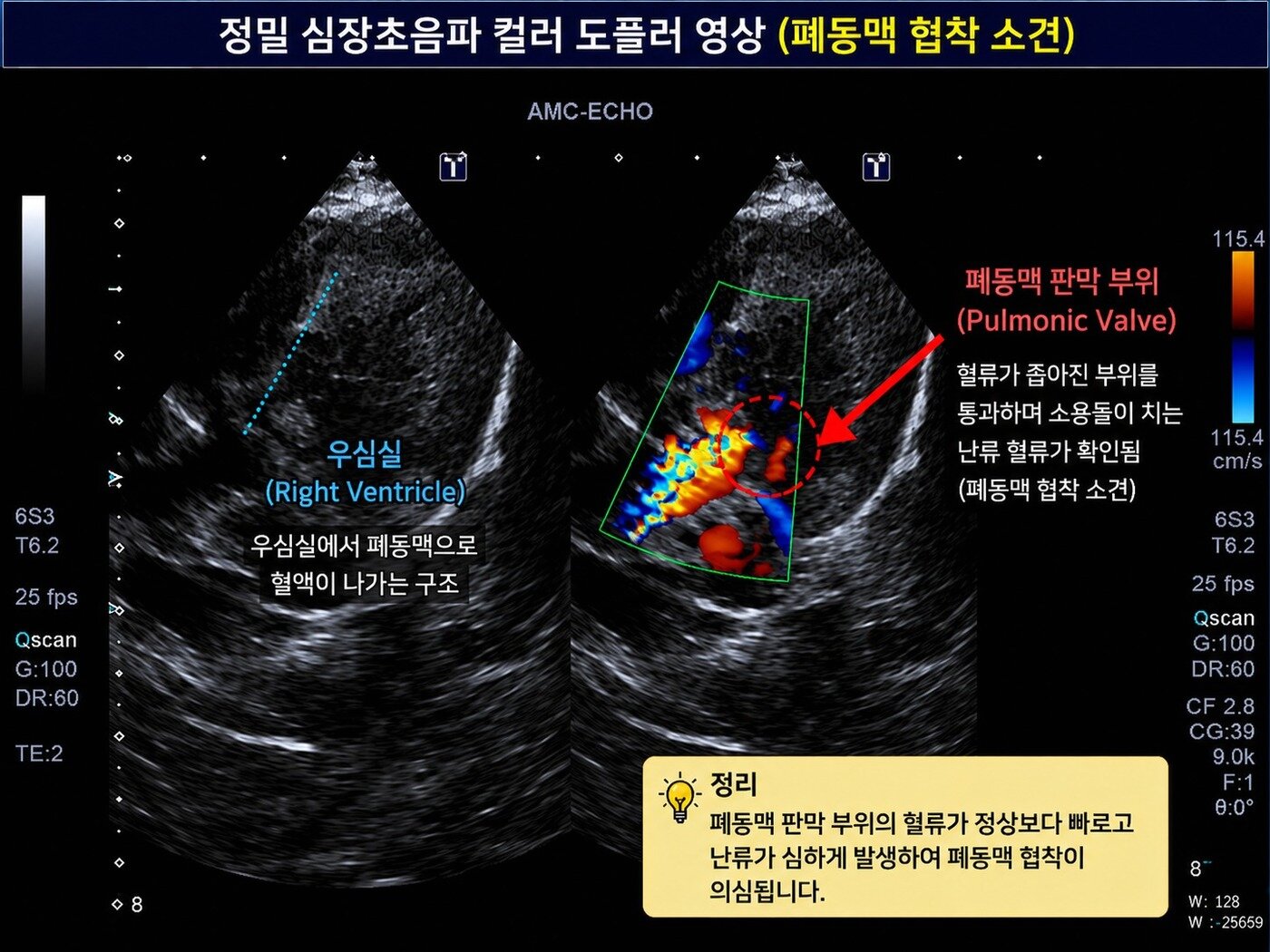 본문 이미지 - 코코는 더케어동물의료센터에서 정밀 심장초음파를 받은 결과 폐동맥 협착이 확인됐다(병원 제공). ⓒ 뉴스1