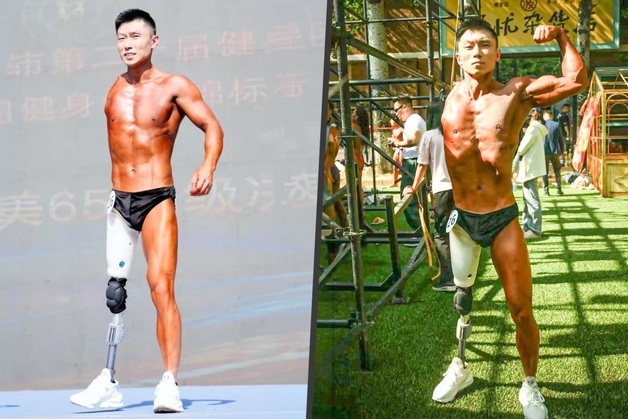 "어떻게 저 몸으로"…교통사고로 팔·다리 잃은 남성, 보디빌딩 대회 섰다