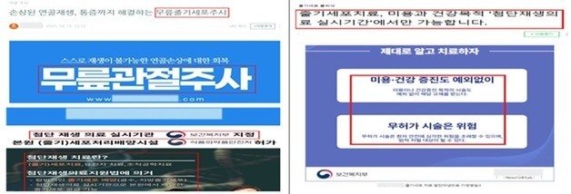 "재생의료라더니 일반 주사?"…거짓·과대광고 무더기 적발