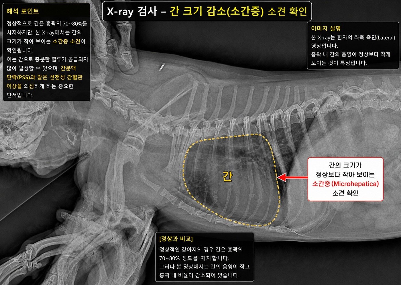 본문 이미지 - 흉부 엑스레이 검사 결과 확인된 소간증(더케어동물의료센터 제공) ⓒ 뉴스1