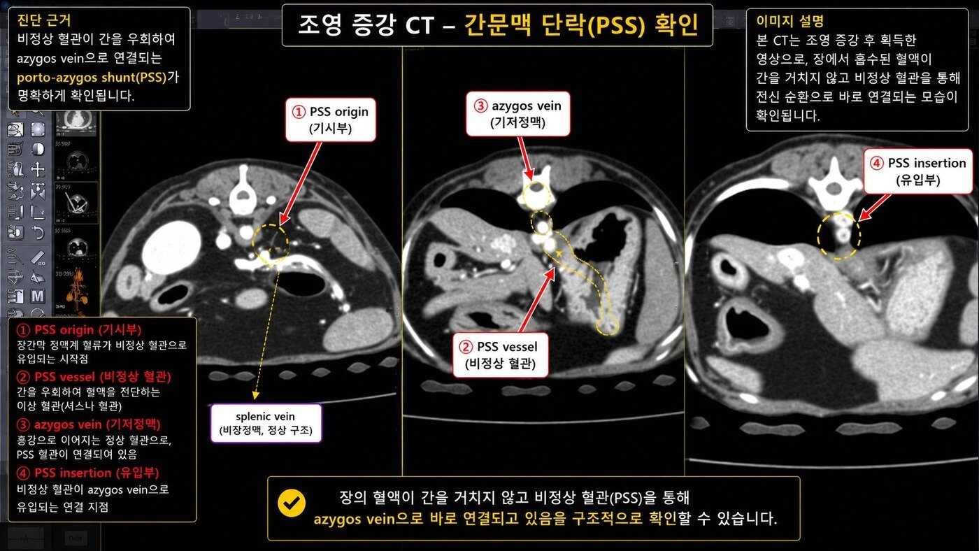 본문 이미지 - 조영 증강 CT 검사로 선천적인 간혈관 이상을 확인한 모습(더케어동물의료센터 제공) ⓒ 뉴스1