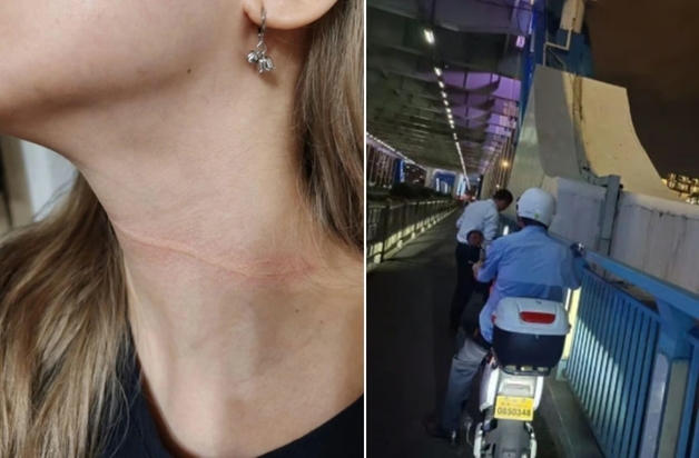 "낚싯줄에 목 잘려 죽을 뻔"…밤길 자전거 타고 다리 건너던 여성 아찔