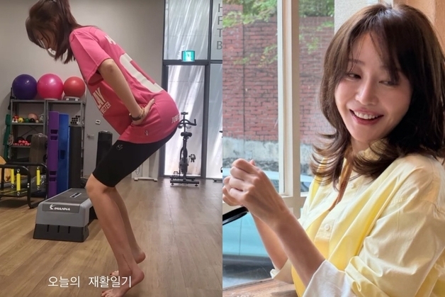 엄지원, 발목뼈 산산조각 수술 후 재활 근황…선명한 수술 자국
