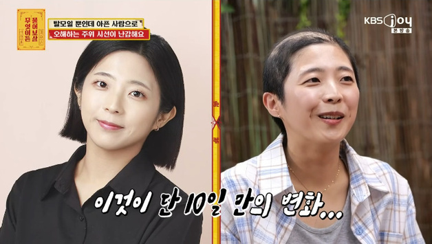 '물어보살' 급성 탈모 女 등장…"10일 만에, 원인 몰라"