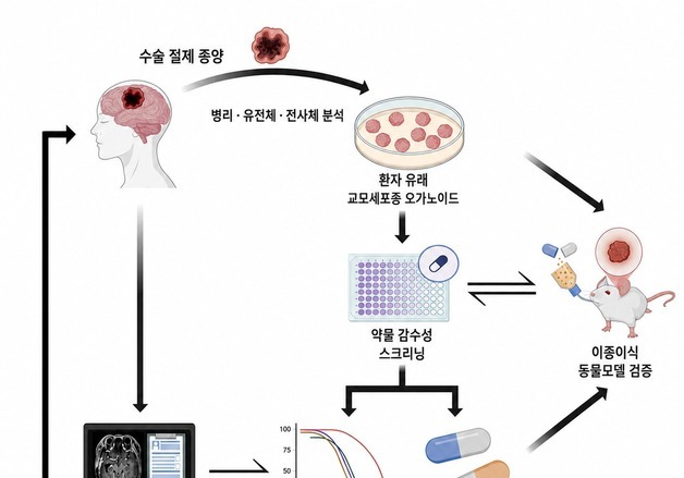 오가노이드로 몸 밖에서 난치성 뇌종양 치료반응 미리 예측