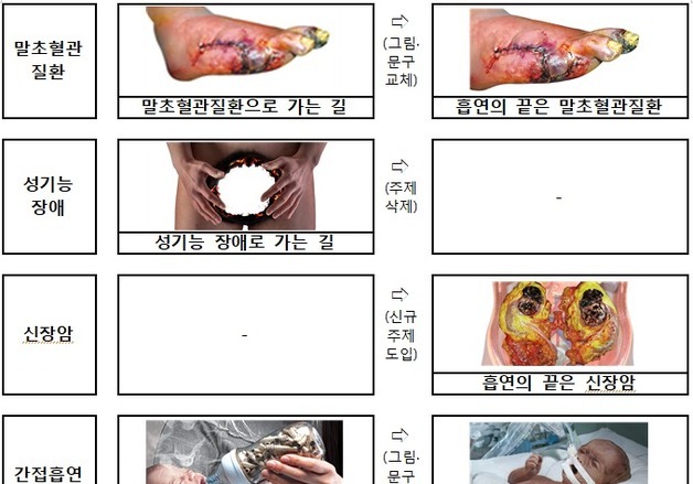 "흡연의 끝은 폐암"…답뱃갑 건강경고 위험 직관적으로 바뀐다