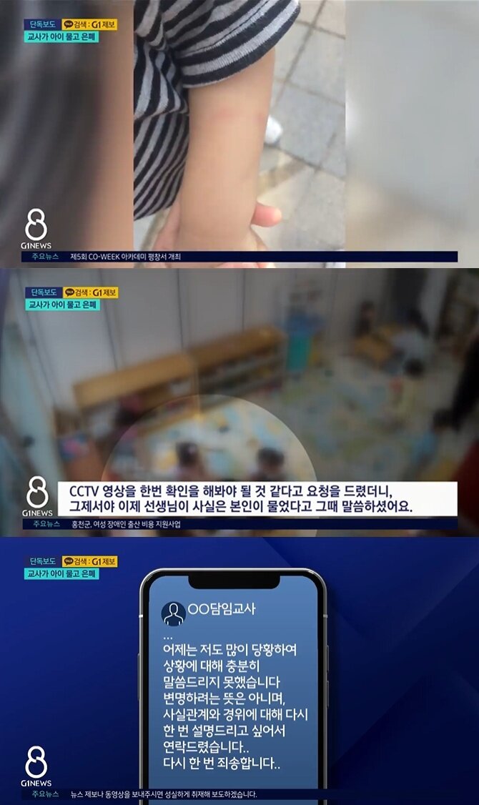 본문 이미지 - G1 갈무리