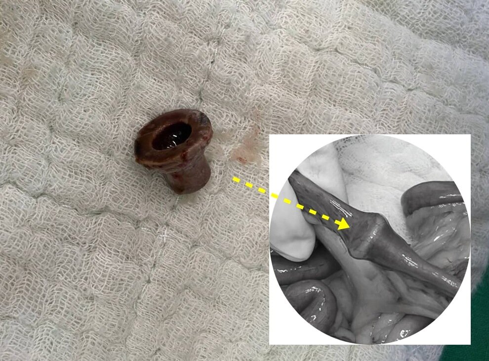 본문 이미지 - 소장을 막고 있던 고무 재질의 이물(더케어동물의료센터 제공) ⓒ 뉴스1