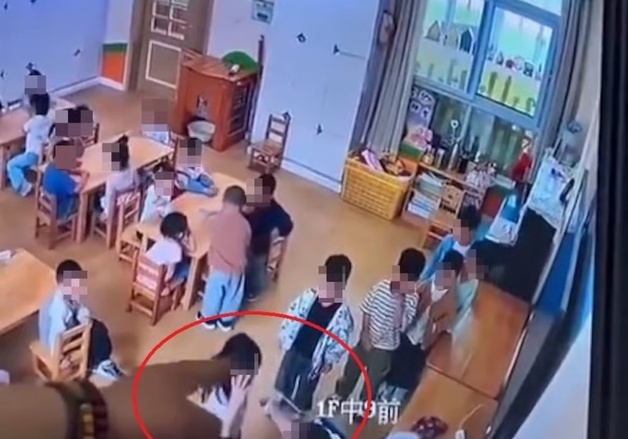 4살 여아 입술에 뜨거운 '글루건' 쏜 교사…발뺌하다 "실수였다"