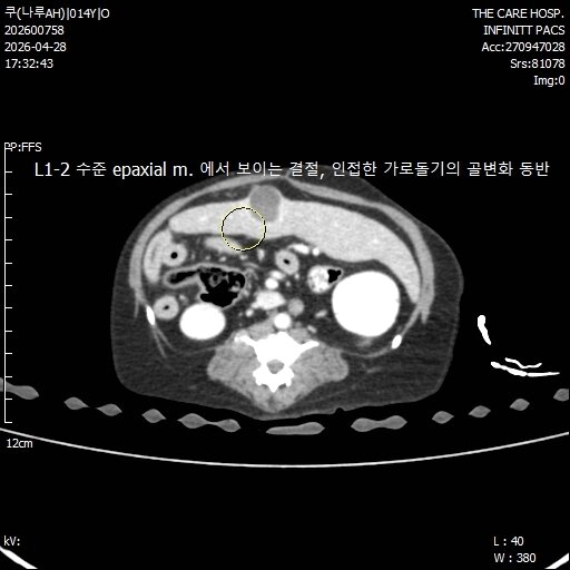 본문 이미지 - 근육에서 결절성 병변이 확인된 모습(더케어동물의료센터 제공) ⓒ 뉴스1