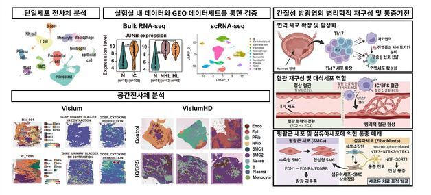 원인 몰랐던 간질성 방광염, 치료 단서 발견…"희망 보인다"