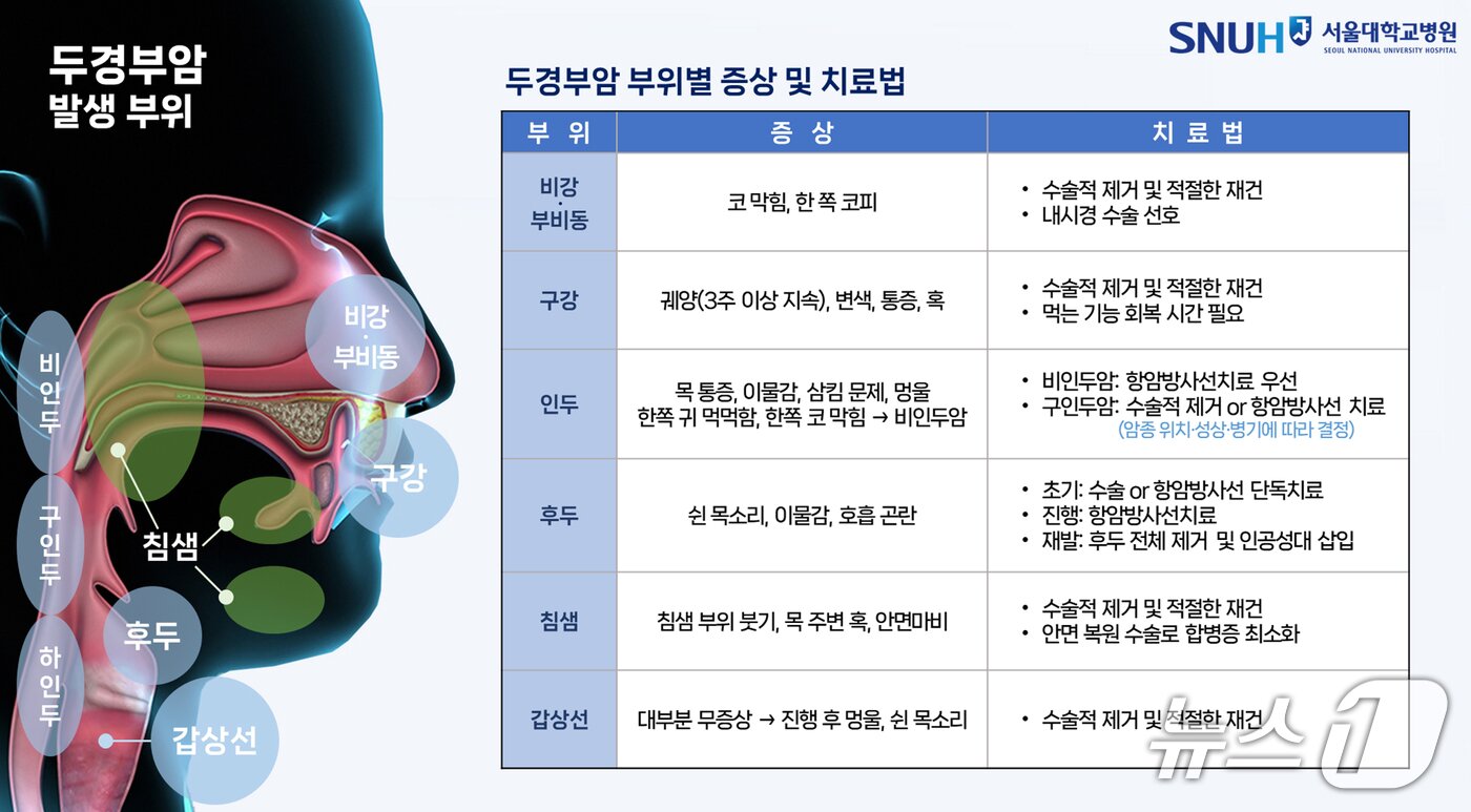 본문 이미지 - 두경부암의 발생 부위별 증상 및 치료법.(서울대병원 제공)