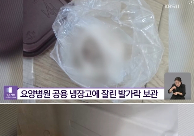 쌈장, 반찬 넣어두는 냉장고에…절단된 환자 발가락 보관한 요양병원