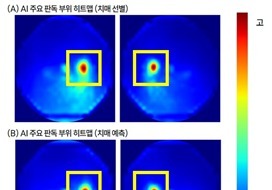 눈 사진 한 장으로 치매 위험 예측…국내 연구진 AI 개발
