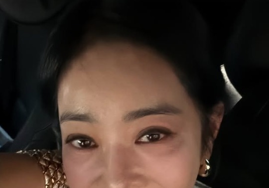 "폐암 졸업"…이혜영, 밝은 미소 속 건강해진 근황 공개 [N샷]