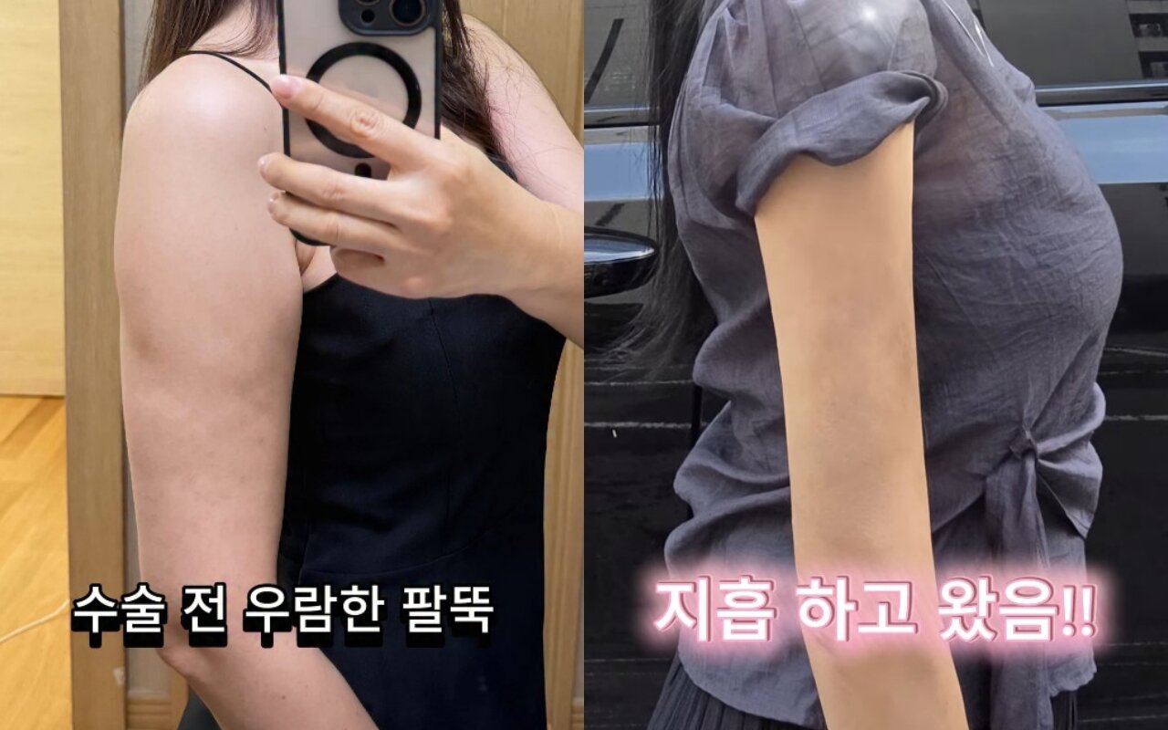 본문 이미지 - 김하영 인스타그램