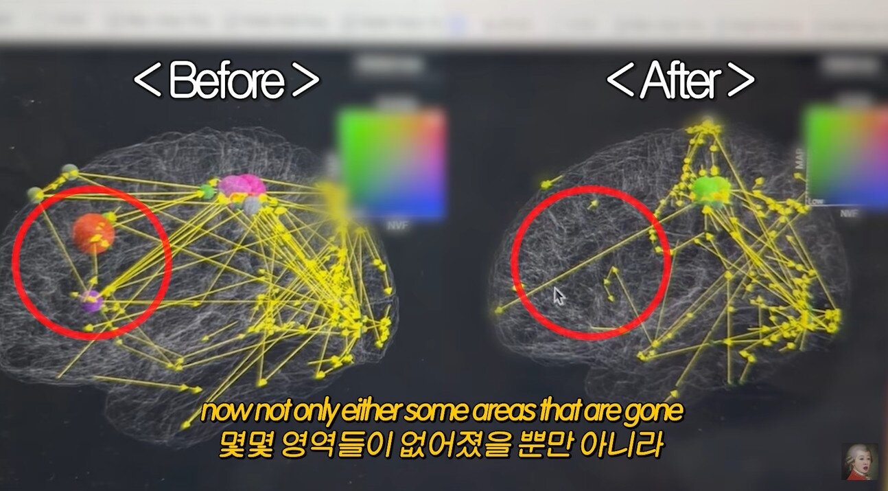 본문 이미지 - 유튜브 채널 '공부왕찐천재 홍진경' 캡처