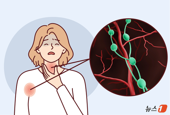 [100세건강] 겨드랑이 멍울 커지면 림프종 의심…카티 치료 주목