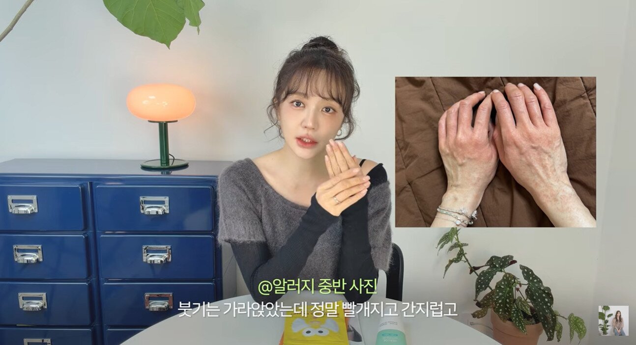 본문 이미지 - 윤은혜/유튜브 캡처