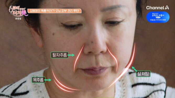 본문 이미지 - 채널A '뷰티 클리닉 터치미' 방송 화면 캡처