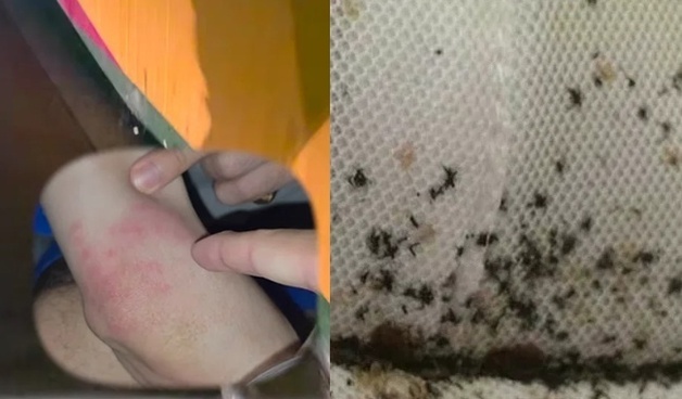 한두마리도 아니고, 벽 틈에 빈대 득실득실…충격의 부산 찜질방