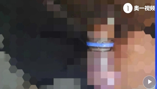 "어떻게 될지 궁금해 그곳에 콜라병 끼웠다"…2시간 사투 끝 응급수술한 남성