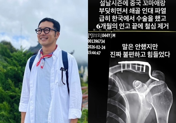 이켠, 중국 꼬마와 부딪혀 쇄골 인대 파열→6개월 만에 철심 제거 "인고 끝에"